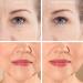 Expression Line Smoothing Forehead Patch | Medical-Grade Silicone for Anti-Aging & Overnight Wrinkle Reduction | 20X Reusable Beautify Brow Lift - Buy Online on GoSupps.com