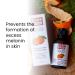 Dark Spot Serum for Melasma & Hyperpigmentation Correction - Natural Treatment for Discoloration - Buy Online on GoSupps.com