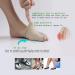 Bunion Corrector and Relief Sleeve with Gel Pads - Orthopedic Brace for Men and Women - 2 Pair Bunion Corrector for Daytime Relief - Buy Online on GoSupps.com