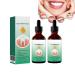2 pieces of dentizes gum regrowth drops gum relief drops repair of gum loss gel for gum regeneration repair of gum decline 30ml essence1