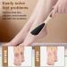 Ruayia Callus Remover Double-Sided Foot Scraper Callus Remover Dead Skin Callus Remover Feet Callus Shaver for Foot and Hand Callus Removal on Wet and Dry Feet - Pink - Buy Online on GoSupps.com