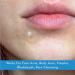 Truly Clear Acne Pimple Patches - Plant Based Hydrocolloid Blemish Zit Dots for Face & Body - Ideal for Cystic Acne - 72 Count Pack - Cruelty-Free Overnight Results - Buy Online on GoSupps.com