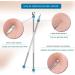 Blackhead Remover Kit Extractor Removal Set Professional Stainless Steel Pimple Popper Tool Treatment for Whitehead Blemish Acne Comedone Pimple Popping (Silver) - Buy Online on GoSupps.com