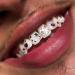 Chamon Tooth Gems | DIY Crystal Tooth Decorations | Pink Dental Jewelry & Gemstones - Buy Online on GoSupps.com