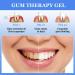 Gum Therapy Gel & Teeth Whitening Pen - Fast & Effective Tooth Whitening (2PC) - Buy Online on GoSupps.com