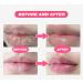 Korean Lip Serum Dark Lip Serum Moisturizing and Nourishing Lip Serum Lips Pink Fresh Treatment Balm for Dry Lips Lighten Lip Wrinkles - Buy Online on GoSupps.com
