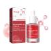 Tongyend Dark Spot Serum Brightening Serum Niacinamide Serum Faded Cream For Dark Spots Dark Spot Corrector For Face Age Spot Remover For Face Face Redness Remover Arbutin Serum Acne Scar 30ml
