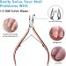 Stainless Steel Cuticle Nippers & Pusher Set with Scissors - Pink, Durable Manicure Tools - Buy Online on GoSupps.com