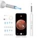 Ear axle removal Otoscope Vitcoco WiFi ear cleaner camera 5MP HD Ohr camera IP67 Waterproof earpiece 3.5mm lens ear endoscope with 6 LEDs for iPhone iPad and Android smartphones (white)
