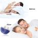 Cindiat Electric Anti-Snoring Device with Silicone Fixation Belt - Stop Snoring Solution for Men and Women (Blue) - Buy Online on GoSupps.com