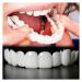 GKOKG 2 Pairs Adjustable Nature and Comfortable Top and Bottom Regain Beautiful Smile for Men and Women White