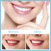 Buy WTTFC Fake Teeth - 2 Pairs of Temporary Dentures for Men & Women | Artificial Dentistry Solutions - Buy Online on GoSupps.com
