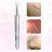 Buy SWTYEXT 6-Piece Blackhead Remover Kit - Best Pimple Extractor Tools for Clear Skin - International Shipping - Buy Online on GoSupps.com