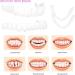 Instant Snap-On Veneers: 2 Pairs Cosmetic Temporary Dentures for Men and Women - Top and Bottom Clip-In Fake Smile Teeth - Buy Online on GoSupps.com