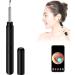 BA1 Ear Wax Removal Tool with Camera - 1080P Wireless Ear Otoscope Kit for Earwax Removal - Compatible with iPad & Android - Includes 12 Silicone Ear Tips - Black - Buy Online on GoSupps.com