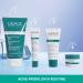 Uriage Hyseac 3-regul+ | Best Face Moisturizer for Oily Acne-Prone Skin | Salicylic Acid AHA Zinc | Clear Skin Solution | 1.35 oz - Buy Online on GoSupps.com