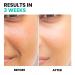 Conatural Vitamin C Face Wash 150ml - Sulfate-Free Paraben-Free Brightening Cleanser for Radiant Skin - Natural Hydrating & Gentle for All Skin Types - Buy Online on GoSupps.com