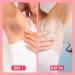 Dear Kitty Intimate Serum Evening Cream - Natural Dark Spot Corrector for Private & Sensitive Areas - Underarm Skin Improving Cream (1oz) - Buy Online on GoSupps.com