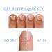 Onyxoguard Nail Growth & Repair Serum - Strengthening Conditioner for Brittle Peeling Nails (3PCs) - Buy Online on GoSupps.com