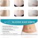 Silicone Scar Sheets for C-Section Surgery, Burn, Keloid, Acne - 4 Sheets (2 Month Supply) - Buy Online on GoSupps.com