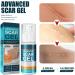 YoNGBAO Scar Removal Cream: Natural Extract, Brightens Skin, Improves Surgical Scars - Buy Online on GoSupps.com