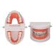 ANGGREK Dental Typodontic Tooth Model with Orthodontic Metal Mount | Ideal for Teaching & Research - International Shipping Available - Buy Online on GoSupps.com