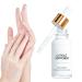 Adoucissant pour les cuticules lors de la p dicure | Huile de 20 ml pour r parer les cuticules endommag es Solution pour enlever la peau morte pour les femmes la beaut la manucure la p dicure