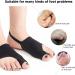 Orthopedic Bunion Corrector Sleeve (2pcs) Black - Reduce Pressure & Eliminate Soreness - for Waiters - Size Small - Buy Online on GoSupps.com