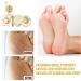Natural Anti-Cracking Frost Repair Cream for Hands & Feet | Cracked Skin Relief & Regeneration | Winter Skin Care - Buy Online on GoSupps.com
