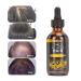 M&A Organic Anti Hair Loss Serum 60ml | Hair Growth Solution | International Shipping - Buy Online on GoSupps.com