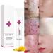 Onkessy Repair Acne Cream - Pimple Treatment for Men and Women - Hydrating & Oil Control Formula for Quick Acne Removal - Buy Online on GoSupps.com