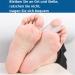 Gel Bale Protection 8-Pack - Big Toe Spreader for Hallux Valgus Relief | Pain-Reducing Bale Pads - Buy Online on GoSupps.com
