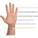 Adjustable Black Healing Bracelet for Movement Disorders - Anti-Indulgence Velcro Fastener Unisex - XLarge 10 (25.4 cm) - Buy Online on GoSupps.com