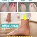 WCXTY Orthopedic Bunion Corrector Sandals for Men - Breathable, Lightweight, Summer Footwear for Plantar Fasciitis Relief - Buy Online on GoSupps.com