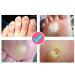 Corn Cream Foot Plaster - Callus Remover Pad for Corns and Calluses - Buy Online on GoSupps.com