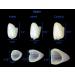 Dental Temporary Crown Kit - 50 PCS Anterior Front Bundle with Fitting Beads for Missing/Broken Teeth - Buy Online on GoSupps.com