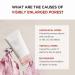 Buy SKIN1004 Madagascar Centella Poremizing Light Gel Cream 75ml | Tightens Pores & Soothes Irritated Skin - International Shipping Available - Buy Online on GoSupps.com