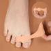 Toe Separator for Overlapping Toes - 2 Gel Toe Spreaders for Big Toes | Comfort & Relief - Buy Online on GoSupps.com