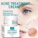 Acne B-Gone Moisturizer Cream - Tea Tree Oil Nighttime Treatment for All Skin Types Fights Pimples Overnight - Buy Online on GoSupps.com
