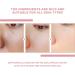 70% Peach Niacinamide Serum Peach 70 Niacin Serum 70% Peach Niacinamide Hydrating Face Serum Nicotinamide Serum Peach Dark Spot Correction Serum Hyperpigmentation Facial Serum - Buy Online on GoSupps.com