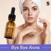 SKIN LABO SkinLabo Active Serum Aha + Bha Eliminates Surface Dead Cells Skin Perfecter with Exfoliating and Purifying Action 15 ml (Old Version) - Buy Online on GoSupps.com