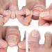 Ingrown Toenail Corrector Pain Relief Treatment Tool Made of Silicone Transparent Simple and Effective - Buy Online on GoSupps.com