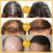 Raw Batana Oil - Natural Hair Restoration for Men & Women | Repair Dry Damaged Hair (3P - Buy Online on GoSupps.com