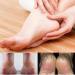 Heel Cups Sleeves - Gel Cushion Pads for Pain Relief | Silicone Cups for Cracked Heels Achilles Tendinitis & Plantar Fasciitis - Unisex - Buy Online on GoSupps.com