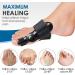 Bunion Corrector Splint - Adjustable Pain Relief & Protection for Women and Men - Buy Online on GoSupps.com