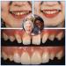 Tooth Repair Kit with Moldable Fake Teeth and Thermal Beads - Temporary Fix for Missing and Broken Teeth - Regain Confidence - Yellow - Buy Online on GoSupps.com