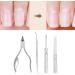 Cuticle Nipper Set 4 Piece Portable Cuticle Manicure Set with Nail Lifter for Home - Buy Online on GoSupps.com