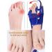 Sportarc Ballenzeh Correction Pain Relief for Large & Curved Toes | Painless Separators for Men & Women | Ideal for Big Toe Correction - Buy Online on GoSupps.com