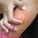 EMCUR Insect Stitch Gel - Soothing & Cooling Relief for Bug Bites | Vegan Formula | 20ml - Buy Online on GoSupps.com