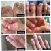 Nail Treatment Nail Renewal Solution Toenails & Fingernails Nail Repairs Essential Oil Protects From Discoloration Brittle And Cracked Nail(12ML) 1PC - Buy Online on GoSupps.com